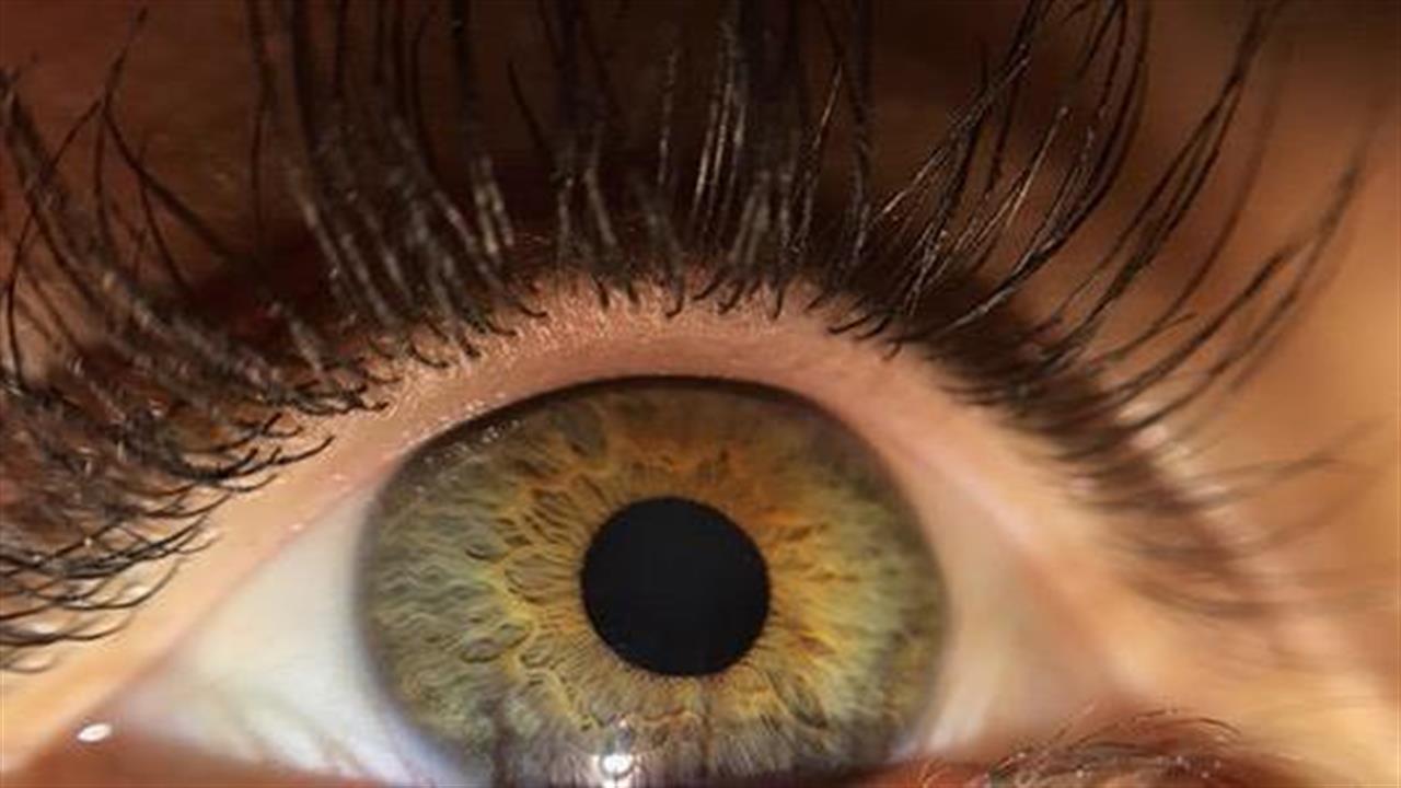 8  στοιχεία που μπορεί να μη γνωρίζετε για τον καταρράκτη στα μάτια